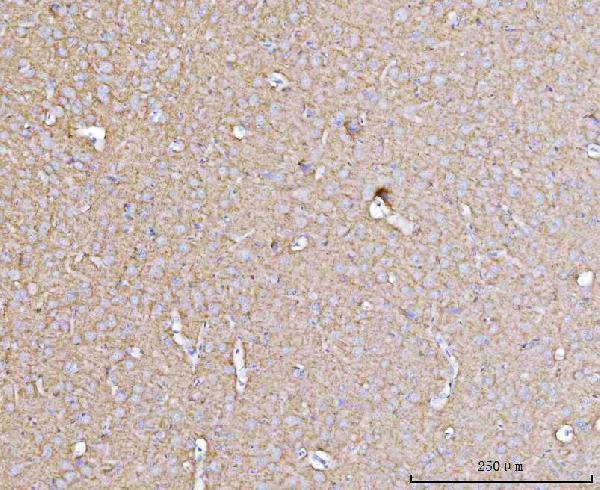 m05530 4 dbn1 primary antibodies ihc testing 4