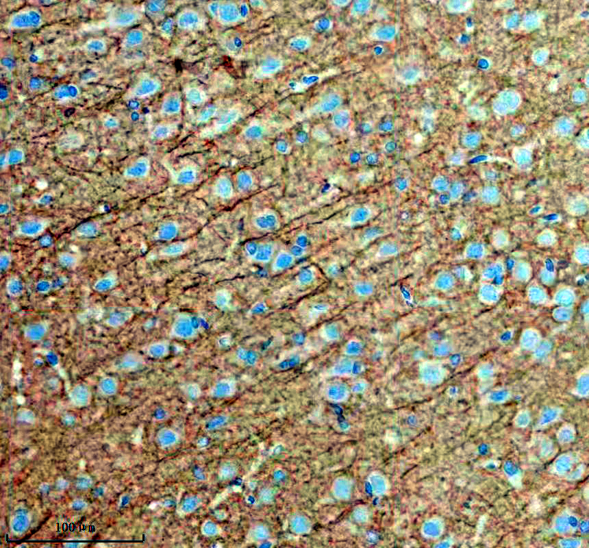 IHC analysis of Drebrin/DBN1 using anti-Drebrin/DBN1 antibody (M05530)