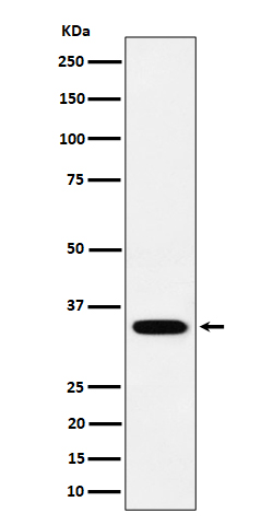 Western blot analysis of PPCS expression in SH-SY5Y cell lysate