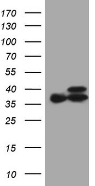 m05572 anti etfa mouse monoclonal antibody clone id oti5c4 wb testing 1