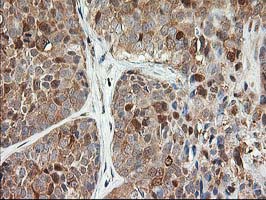 m05573 anti lsm1 mouse monoclonal antibody clone id oti5c6 ihc testing 4