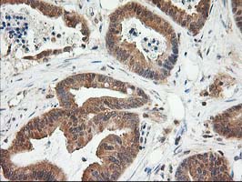 m05573 anti lsm1 mouse monoclonal antibody clone id oti5c6 ihc testing 5