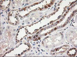 m05573 anti lsm1 mouse monoclonal antibody clone id oti5c6 ihc testing 6