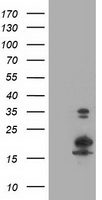 HEK293T cells were transfected with the pCMV6-ENTRY control (Left lane) or pCMV6-ENTRY LSM1 (Right lane) cDNA for 48 hrs and lysed