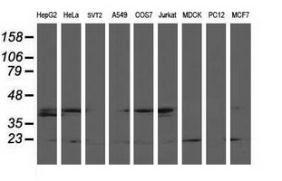 Western blot analysis of extracts (35ug) from 9 different cell lines by using anti-LSM1 monoclonal antibody