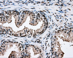m05574 anti ptp epsilon ptpre mouse monoclonal antibody clone id oti3d4 ihc testing 6