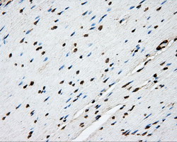 m05574 anti ptp epsilon ptpre mouse monoclonal antibody clone id oti3d4 ihc testing 7