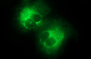 Anti-COL15A1 mouse monoclonal antibody (M05581) immunofluorescent staining of COS7 cells transiently transfected by pCMV6-ENTRY COL15A1
