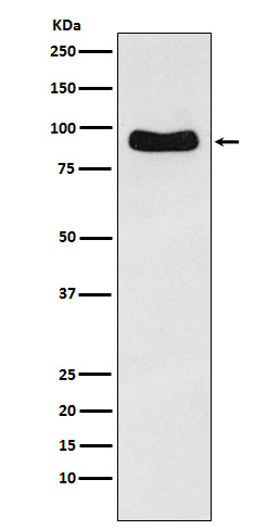 Western blot analysis of Cenexin1/ODF2 expression in Hela cell lysate