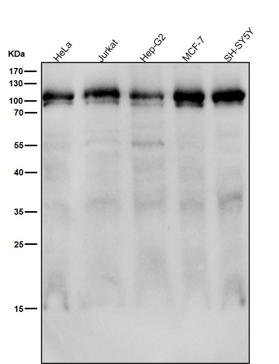 All lanes use the Antibody at 1:2K dilution for 1 hour at room temperature