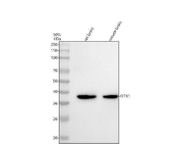  Western blot analysis of Otx1 using anti-Otx1 antibody (M05601)