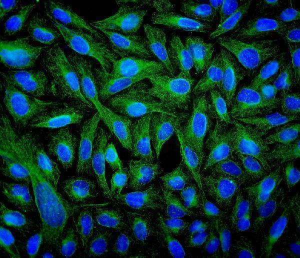 m05613 4 tubulin_beta primary antibodies if testing 4