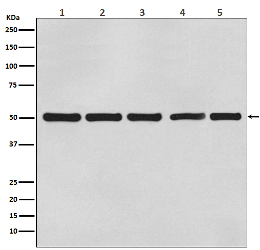 Western blot analysis of beta Actin expression in (1) A431 cell lysate; (2) Rat brain lysate; (3) Mouse kidney lysate; (4) Chicken lung lysate; (5) Hamster spleen lysate with beta Tubulin Mouse Monoclonal Antibody