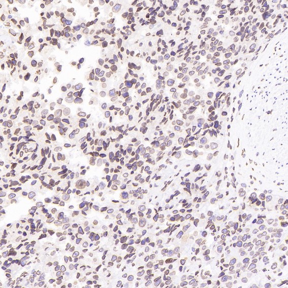 m05613 6 ihc10