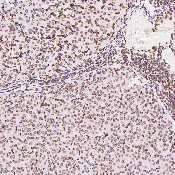 Immunohistochemical analysis of paraffin-embedded Rat stomach, using the Antibody at 1:250 dilution