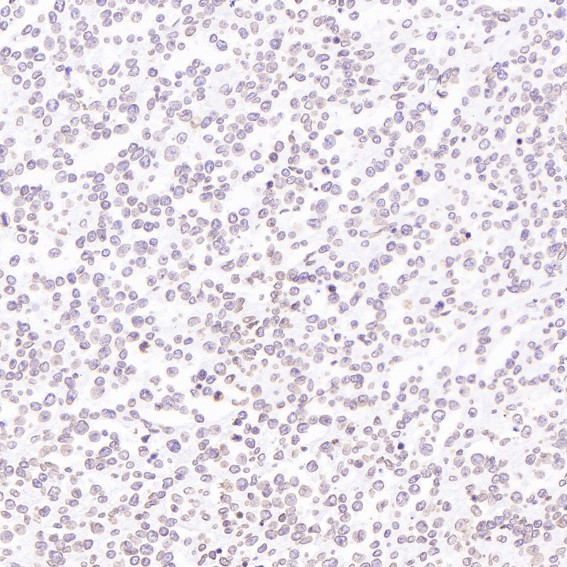 Immunohistochemical analysis of paraffin-embedded Human Hodgkin