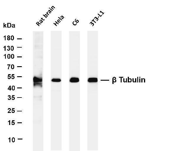 Various whole cell lysates were separated by 4-20% SDS-PAGE, and the membrane was blotted with anti-β Tubulin antibody