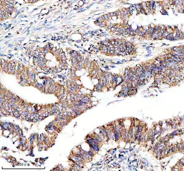  IHC analysis of NDUF-S2 using anti-NDUF-S2 antibody (M05618-1)