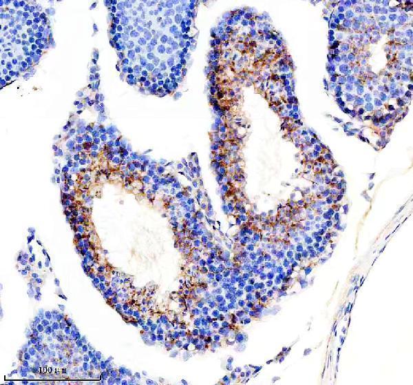  IHC analysis of NDUF-S2 using anti-NDUF-S2 antibody (M05618-1)