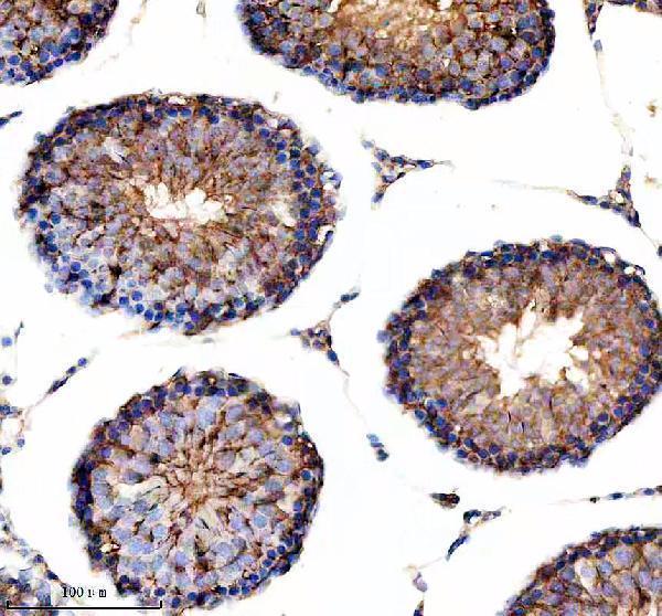 m05618 1 nduf s2 primary antibodies ihc testing 4