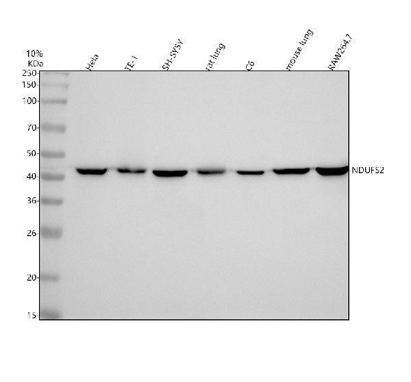  Western blot analysis of NDUFS2 using anti-NDUFS2 antibody (M05618-1)
