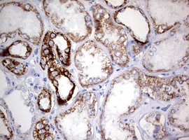 m05618 anti ndufs2 mouse monoclonal antibody clone id oti1d5 ihc testing 10
