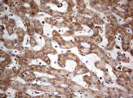 m05618 anti ndufs2 mouse monoclonal antibody clone id oti1d5 ihc testing 11