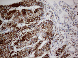 m05618 anti ndufs2 mouse monoclonal antibody clone id oti1d5 ihc testing 12