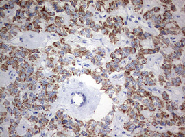 m05618 anti ndufs2 mouse monoclonal antibody clone id oti1d5 ihc testing 4