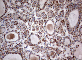 m05618 anti ndufs2 mouse monoclonal antibody clone id oti1d5 ihc testing 5