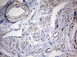 m05618 anti ndufs2 mouse monoclonal antibody clone id oti1d5 ihc testing 6