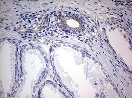 m05618 anti ndufs2 mouse monoclonal antibody clone id oti1d5 ihc testing 7