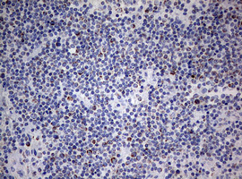 m05618 anti ndufs2 mouse monoclonal antibody clone id oti1d5 ihc testing 8