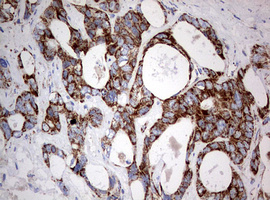 m05618 anti ndufs2 mouse monoclonal antibody clone id oti1d5 ihc testing 9
