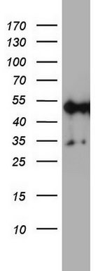 Western blot analysis of A549 cell lysate (35ug) by using anti-NDUFS2 monoclonal antibody
