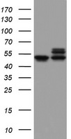 HEK293T cells were transfected with the pCMV6-ENTRY control (Left lane) or pCMV6-ENTRY NDUFS2 (Right lane) cDNA for 48 hrs and lysed