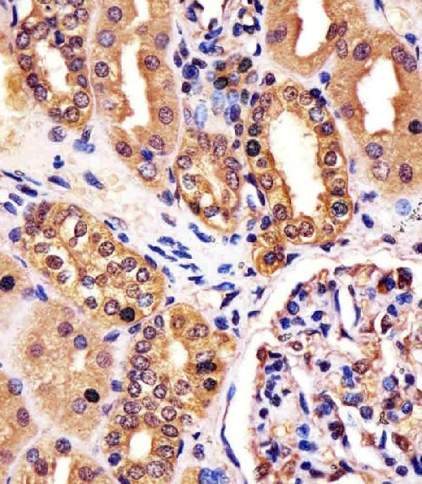 M05620 staining RNF7 in human kidney tissue sections by Immunohistochemistry (IHC-P -paraformaldehyde-fixed, paraffin-embedded sections)