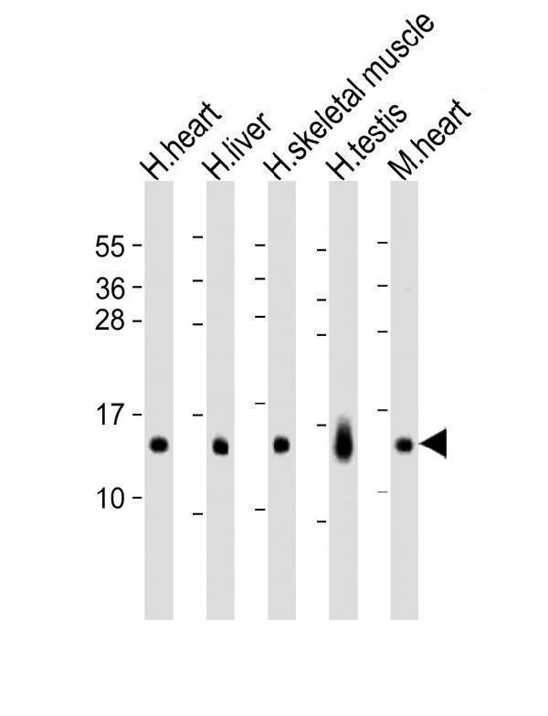 All lanes : Anti-RNF7 Antibody (N-term) at 1:8000 dilutionLane 1: human heart lysatesLane 2: human liver lysatesLane 3: human skeletal muscle lysatesLane 4: human testis lysatesLane 5: mouse heart lysatesLysates/proteins at 20 µg per lane
