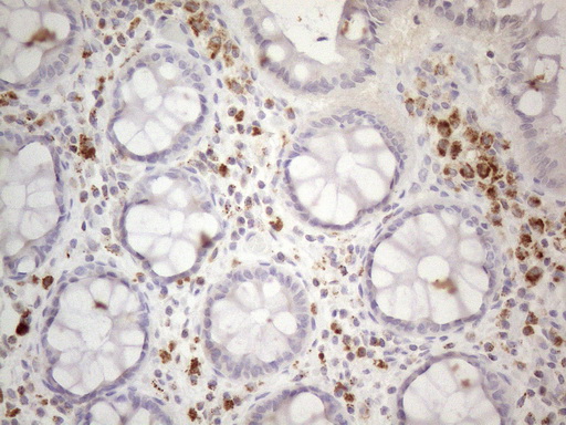Immunohistochemical staining of paraffin-embedded Human colon tissue within the normal limits using anti-PISD mouse monoclonal antibody