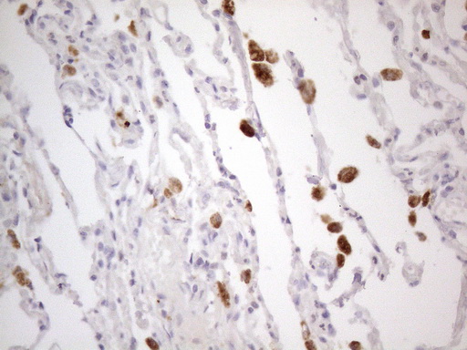 m05625 anti pisd mouse monoclonal antibody clone id oti4g5 ihc testing 4