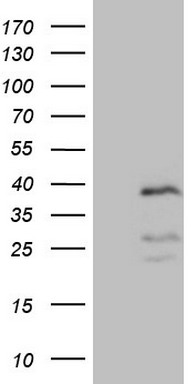 HEK293T cells were transfected with the pCMV6-ENTRY control (Left lane) or pCMV6-ENTRY PISD (Right lane) cDNA for 48 hrs and lysed