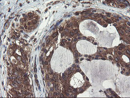 m05645 anti acbd3 mouse monoclonal antibody clone id oti1g2 ihc testing 10