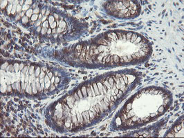 m05645 anti acbd3 mouse monoclonal antibody clone id oti1g2 ihc testing 11