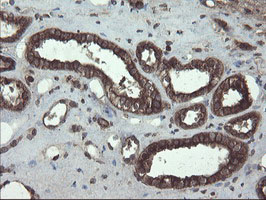 m05645 anti acbd3 mouse monoclonal antibody clone id oti1g2 ihc testing 12