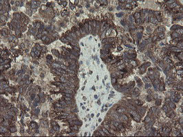 m05645 anti acbd3 mouse monoclonal antibody clone id oti1g2 ihc testing 4