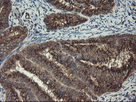 m05645 anti acbd3 mouse monoclonal antibody clone id oti1g2 ihc testing 7