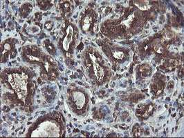 m05645 anti acbd3 mouse monoclonal antibody clone id oti1g2 ihc testing 9