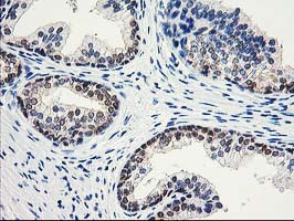 Immunohistochemical staining of paraffin-embedded Human prostate tissue within the normal limits using anti-ACY1 mouse monoclonal antibody