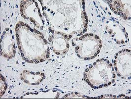 m05650 1 anti aminoacylase 1 acy1 mouse monoclonal antibody clone id oti1d4 ihc testing 4