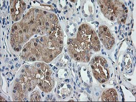 m05650 1 anti aminoacylase 1 acy1 mouse monoclonal antibody clone id oti1d4 ihc testing 5